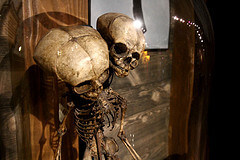 Skeleton at Ripley's